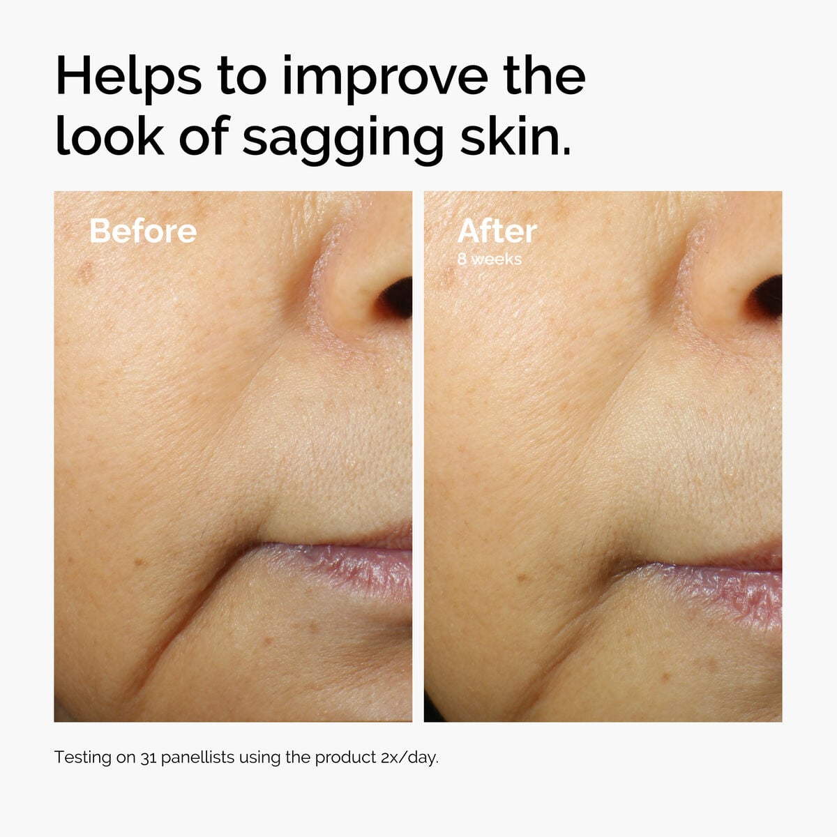 caffeine-3-escin-1-face-serum-v5 ord-caffeine-3pct-escin-1pct-face-serum-before-after-sagging.jpg