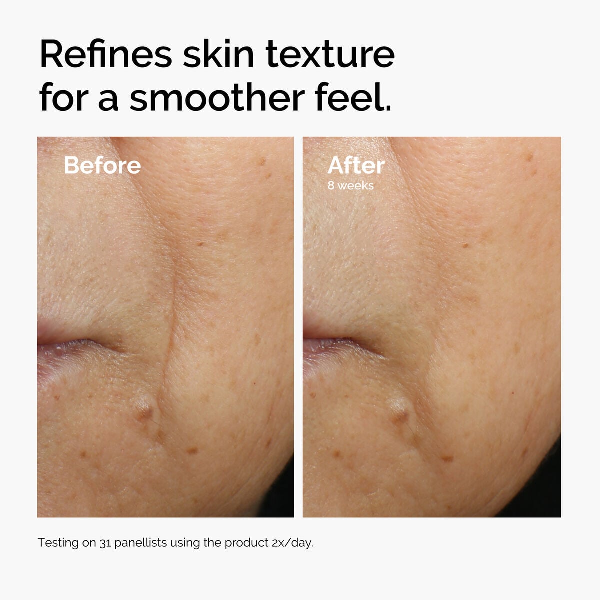 caffeine-3-escin-1-face-serum-v5 ord-caffeine-3pct-escin-1pct-face-serum-before-after-texture.jpg