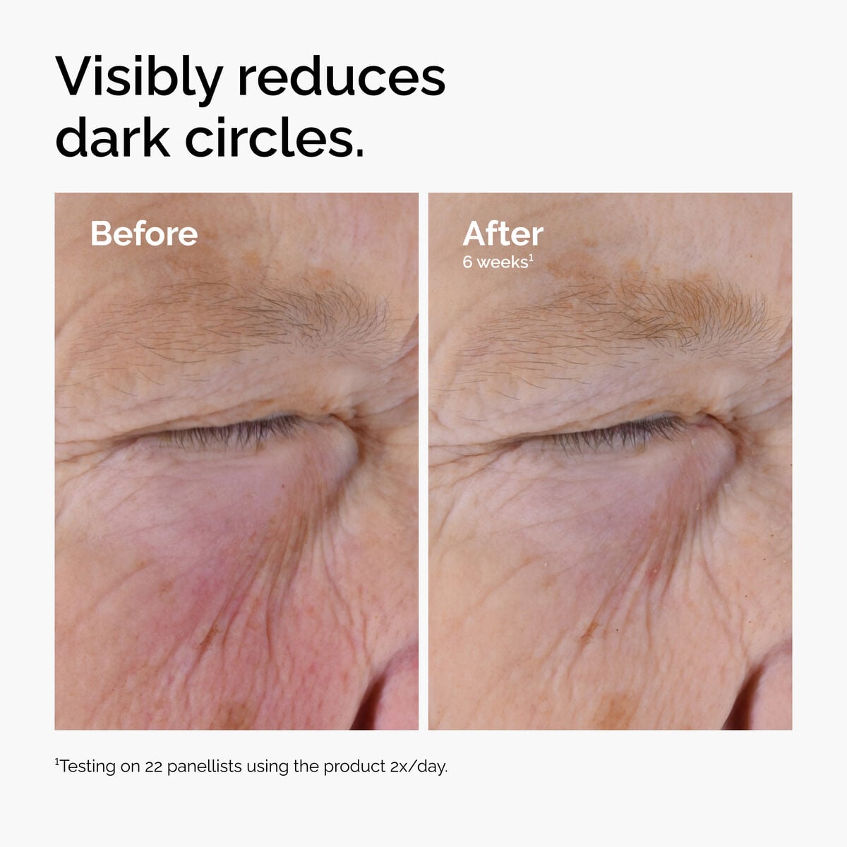 caffeine-solution-5-egcg-eye-serum-d1 ord-caffeine-solution-egcg-dark-circles-before-after.jpg