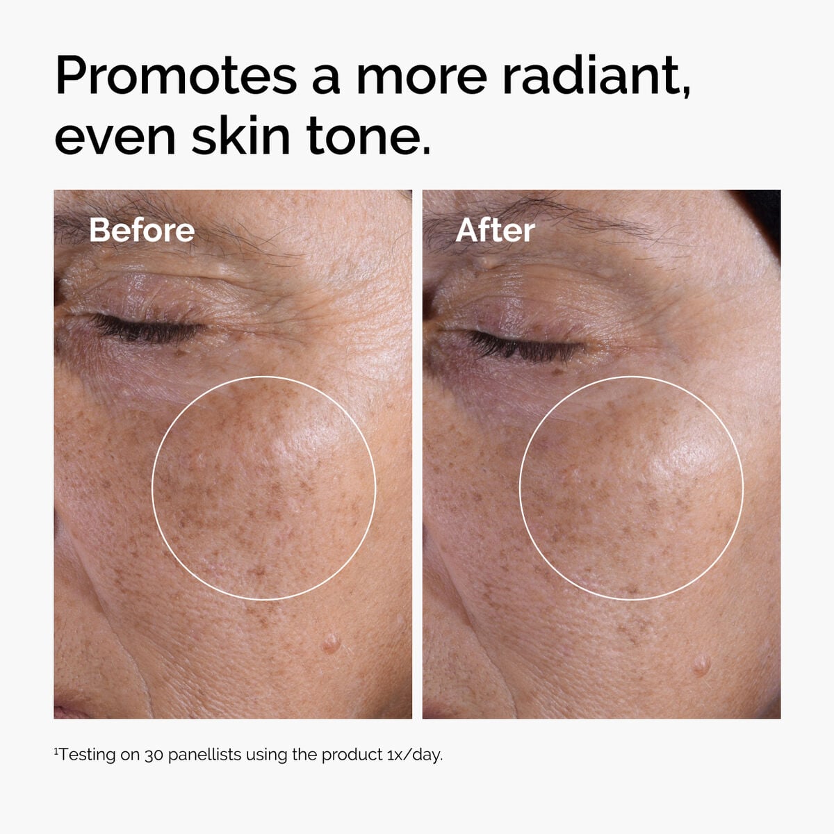 glycolic-acid-7-exfoliating-toner-o4 ord-glycolic-before-after-radiance.jpg