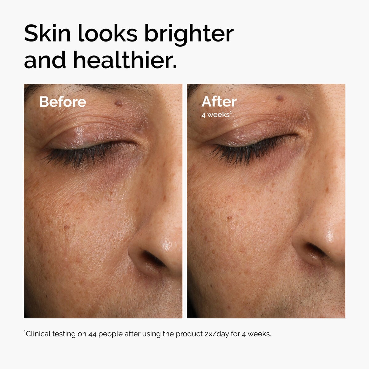 multi-antioxidant-radiance-serum-t1 ord-mars-before-after-healthy.jpg