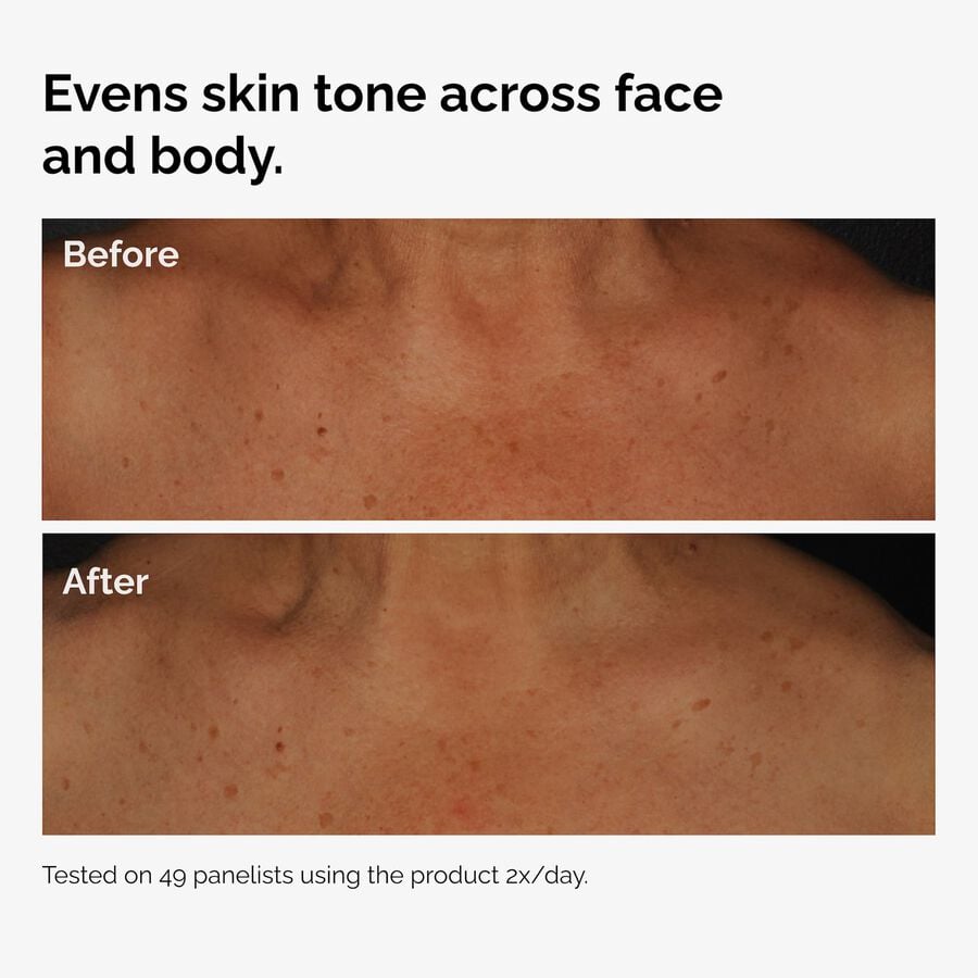 the-body-care-collection-t7 ord-niacinamide-face-body-serum-before-after-even-tone-graphic.jpg