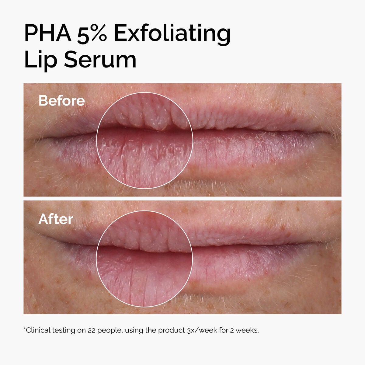 pha-5-exfoliating-lip-serum-s6 ord-pha-5pct-lip-exfoliating-serum-before-after.jpg