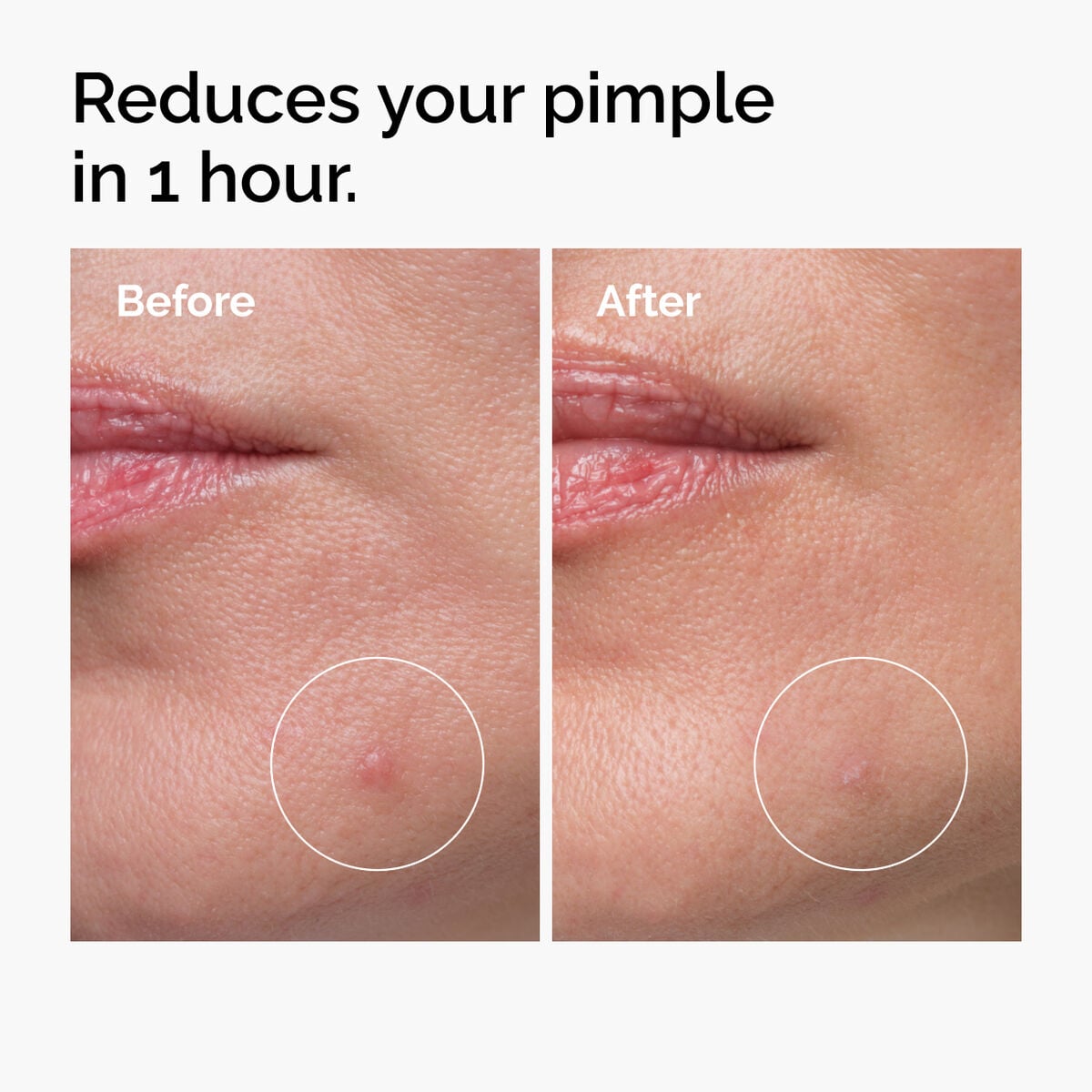 sulfur-10-powder-to-cream-concentrate-b2 ord-sulfur-10pct-powder-to-cream-concentrate-before-after-NA.jpg